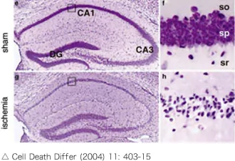 Cell Death Differ (2004) 11: 403-15