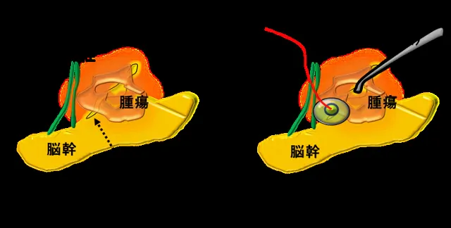 脳神経外科 ビジュアル脳神経外科5 頭蓋底1:前頭蓋窩・眼窩・中